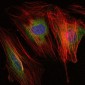 MMP9 Antibody